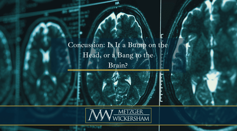 MW-Concussion.2009281711550-2