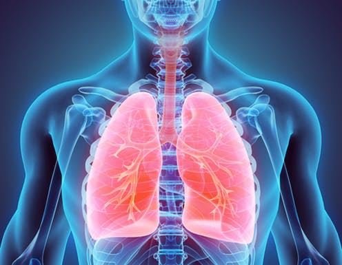 lung.2002111200550-2